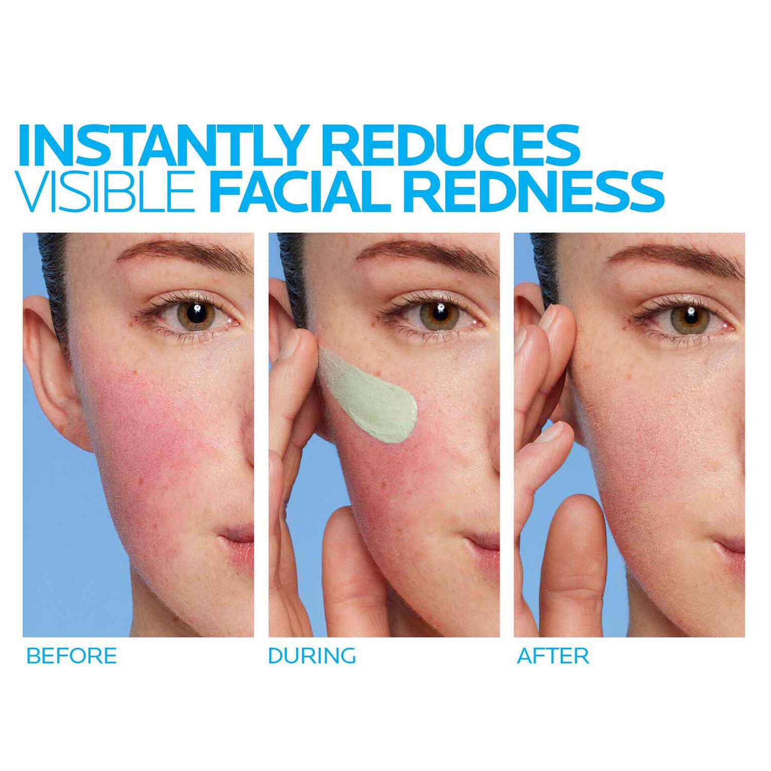 toleriane-rosaliac-ar-face-cream-for-visible-redness-d8 8_Toleriane_Rosaliac-AR-before-after.jpg