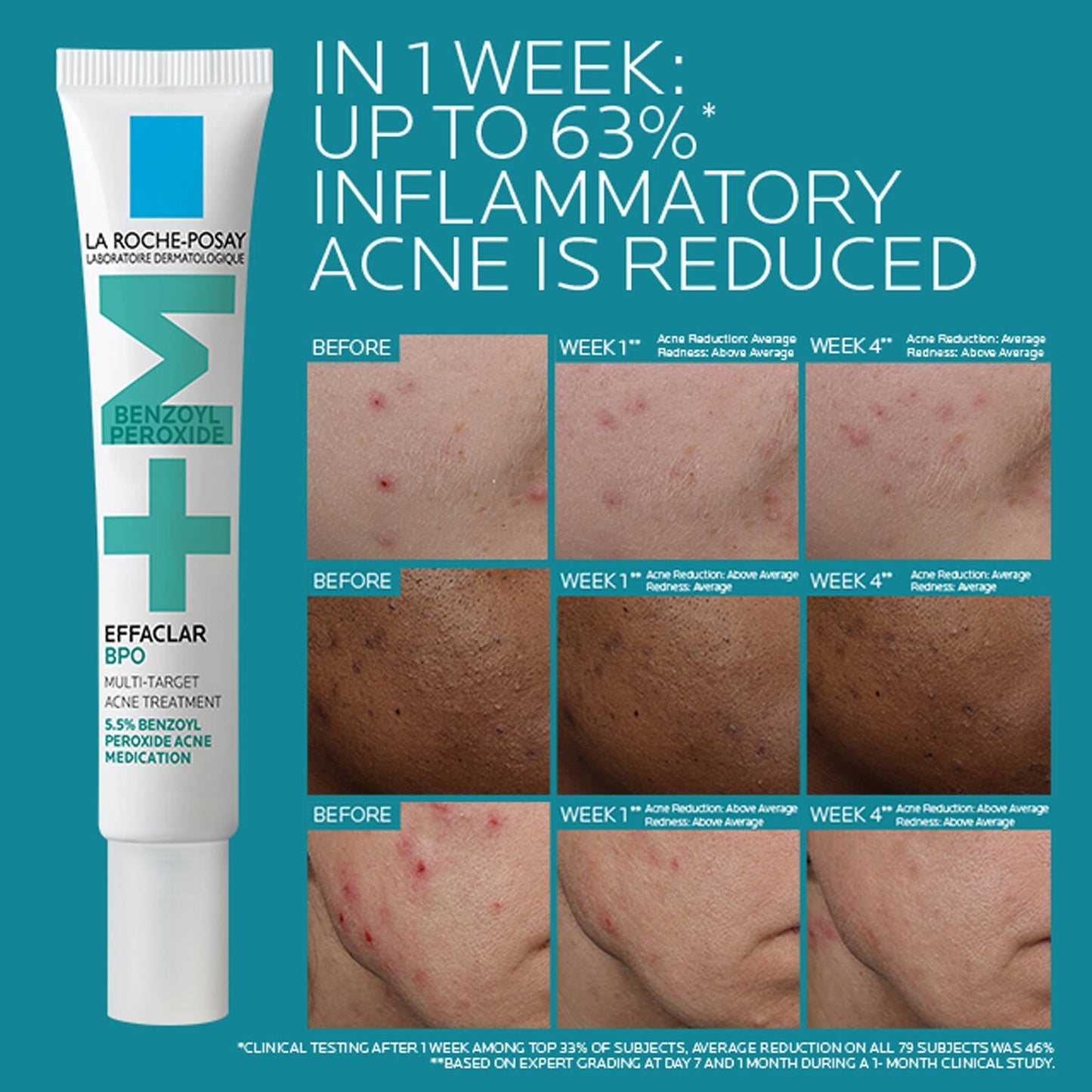 effaclar-bpo-multi-target-acne-treatment-with-5-5-benzoyl-peroxide-e1 EffaclarBPO-ClinicalBA-ATF-1500x1500-2.jpg