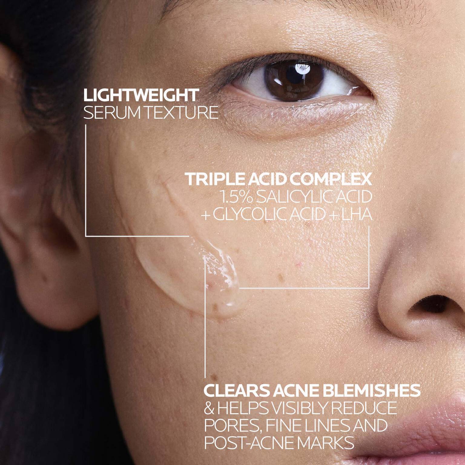 effaclar-salicylic-acid-acne-treatment-serum-h6 LaRochePosay-Product-Effaclar-Effaclar-Serum-30ml-3337875722827-Texture-REV.jpg