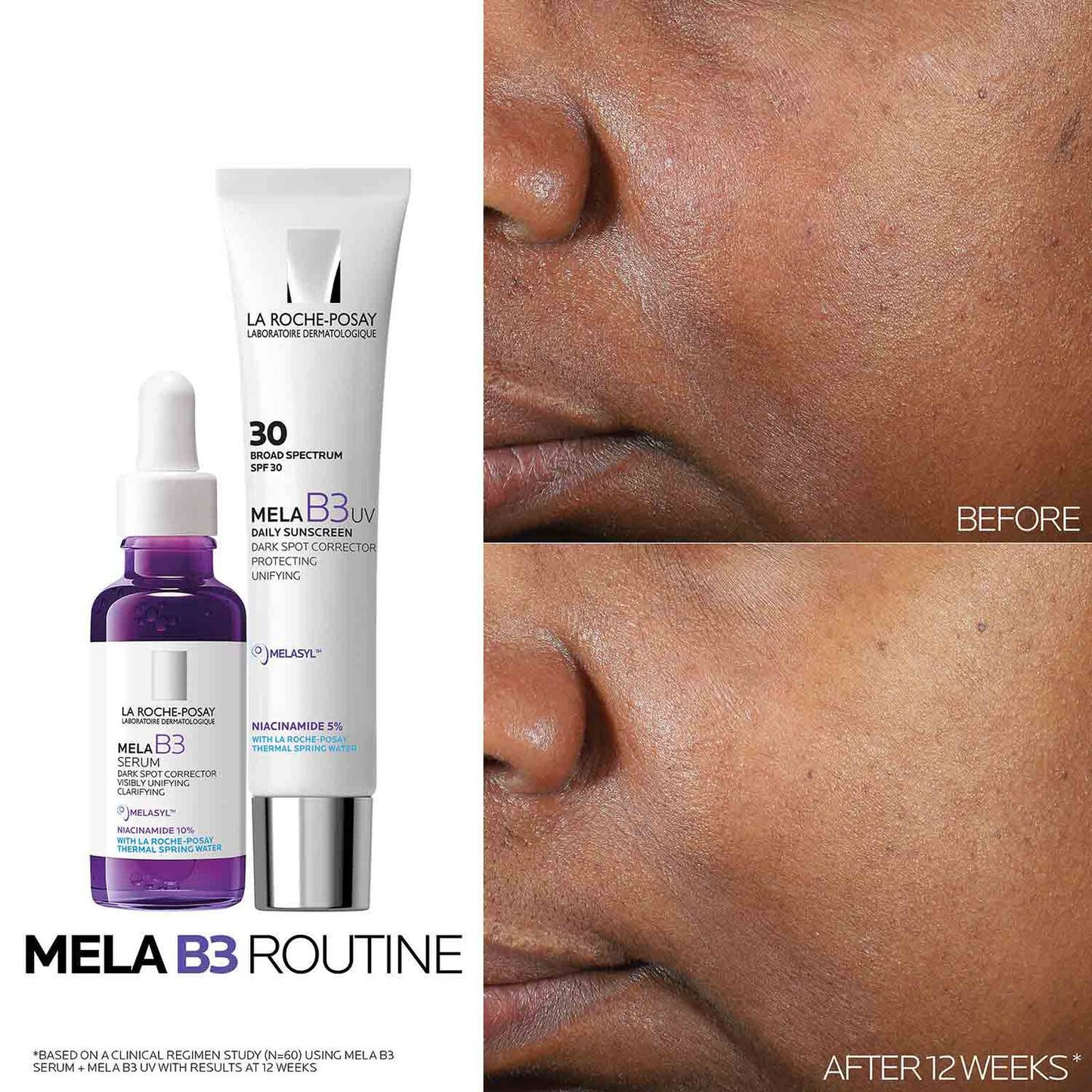 mela-b3-dark-spot-serum-with-melasyltm-niacinamide-y6 Mela-B3-routine_1500X1500.jpg
